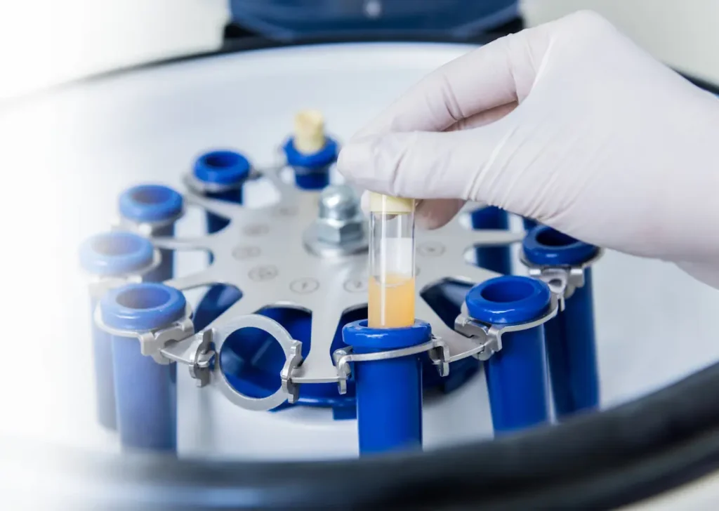 Platelet-rich plasma preparation for regenerative medicine treatment at NeoMedicine Institute Miami