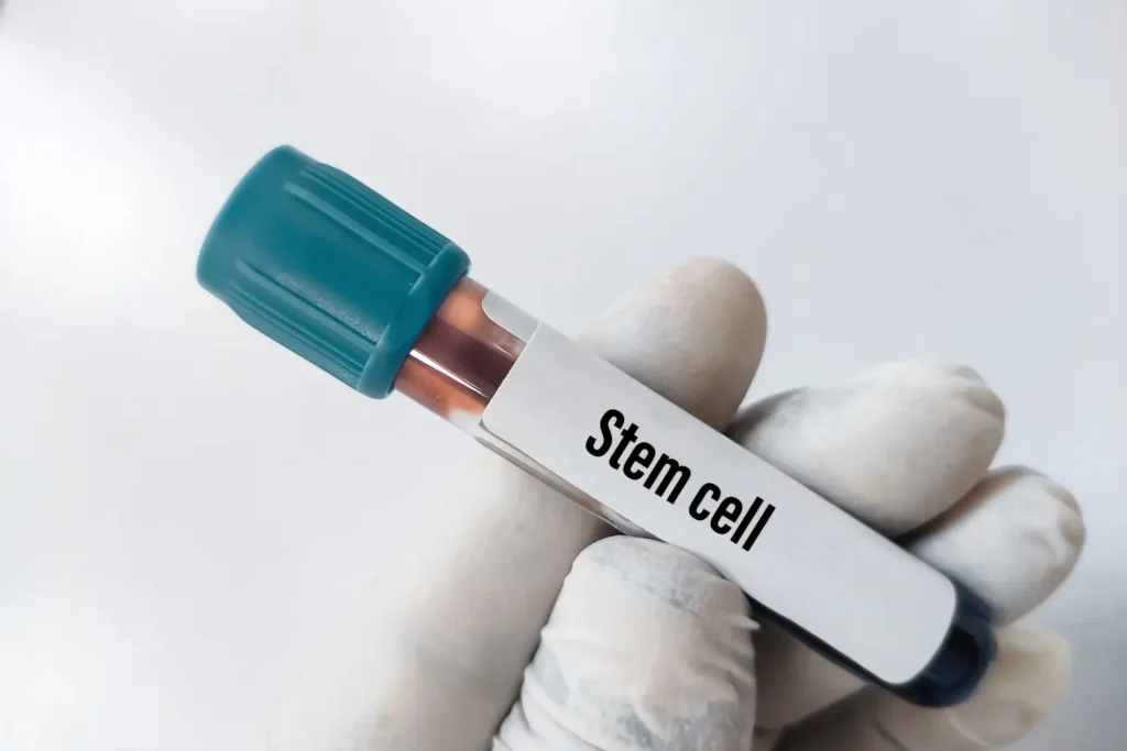 Stem cell blood sample vial representing stem cell banking and longevity research at NeoMedicine Institute Miami FL
