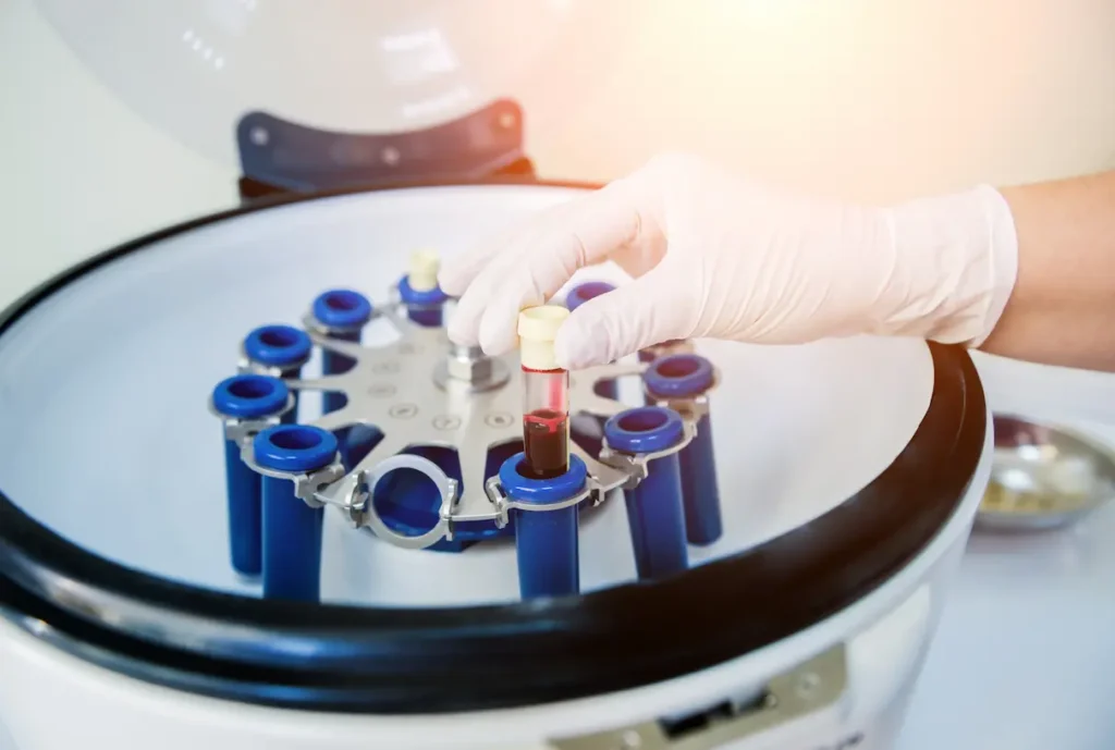 Platelet-Rich plasma preparation with centrifuge at NeoMedicine Institute