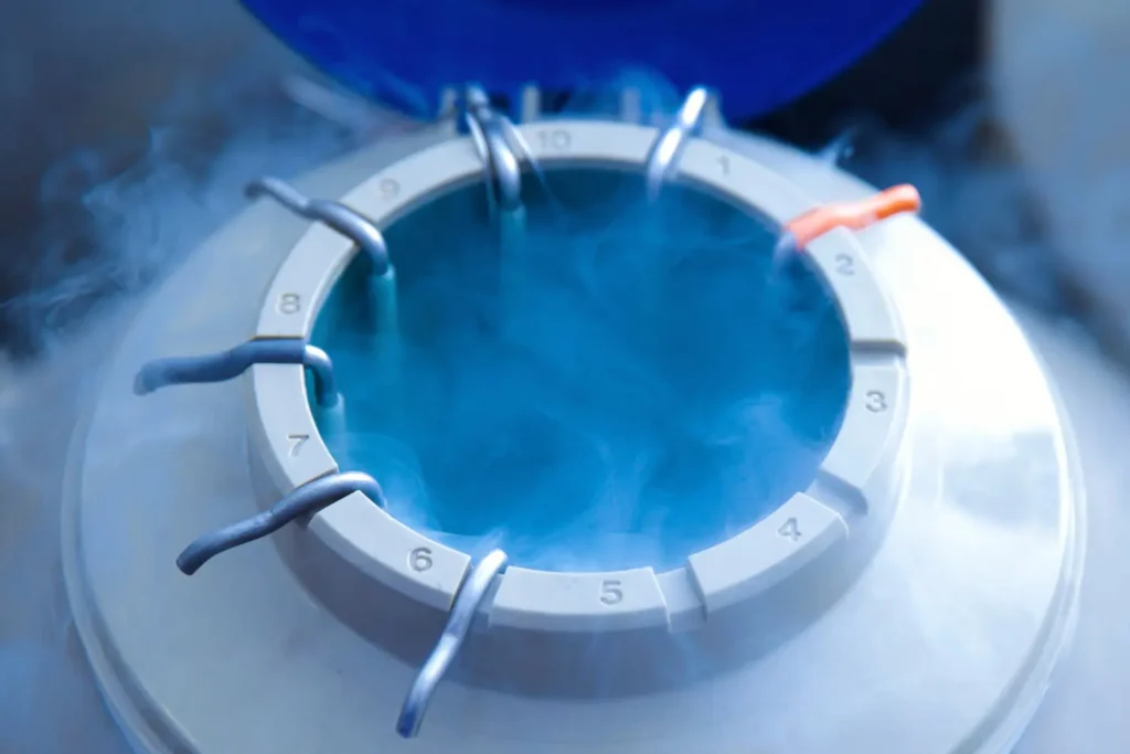 Cryogenic tank preserving stem cells for knee pain